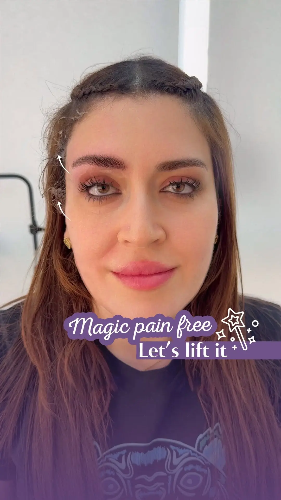 Aesthetic consultation at Clinic M Beirut